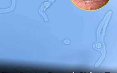 What Are Eye Floaters? Here’s What Eye Doctors Want You to Know