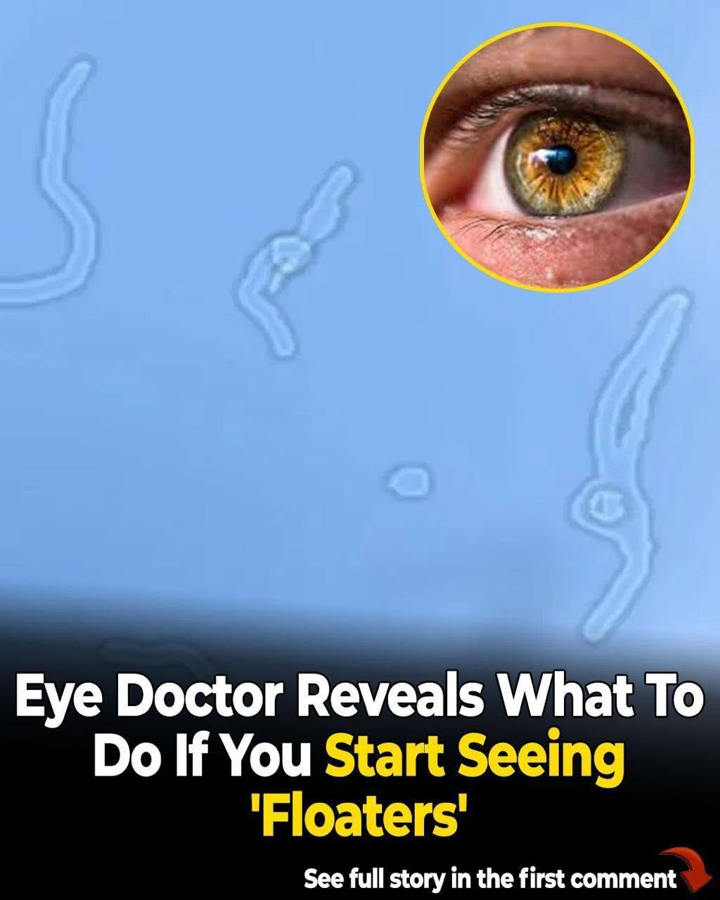 What Are Eye Floaters? Here’s What Eye Doctors Want You to Know