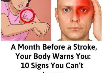 Stroke Warning Signs: Symptoms You Should Never Ignore
