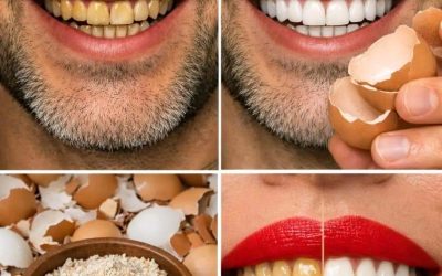 After 5 minutes, the yellow color of the TEETH becomes PEARLY WHITE and shiny 🥚– Method in the first comment