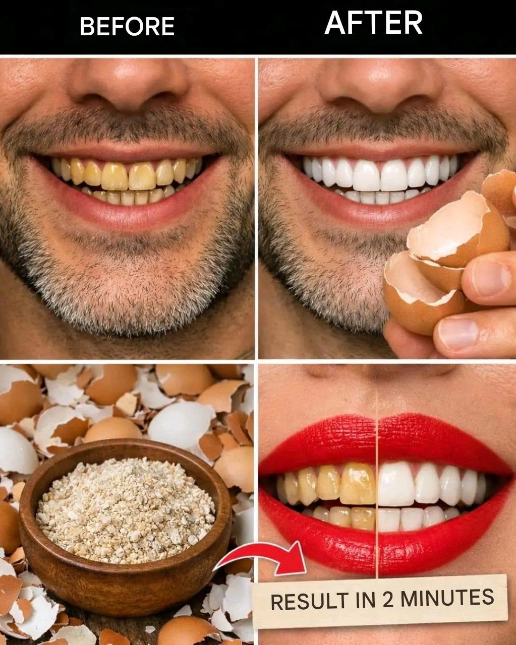After 5 minutes, the yellow color of the TEETH becomes PEARLY WHITE and shiny 🥚– Method in the first comment