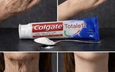 The home treatment that transforms your skin. It looks like I’ve had cosmetic surgery! To keep receiving my recipes, leave a comment…see more in the first comment…