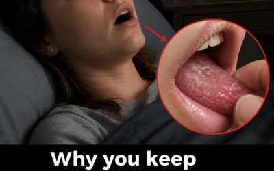 Waking Up With a Dry Mouth? Here’s What Your Body Might Be Trying to Tell You