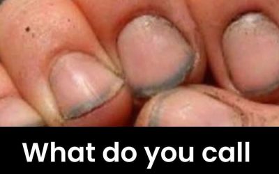 What Your Fingernails Can Reveal About Your Overall Health