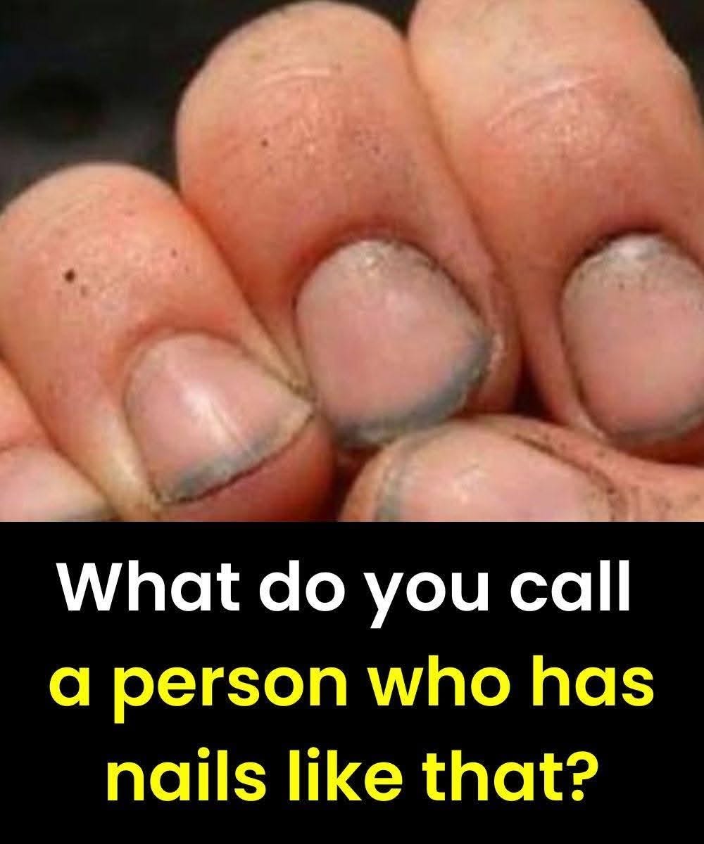 What Your Fingernails Can Reveal About Your Overall Health