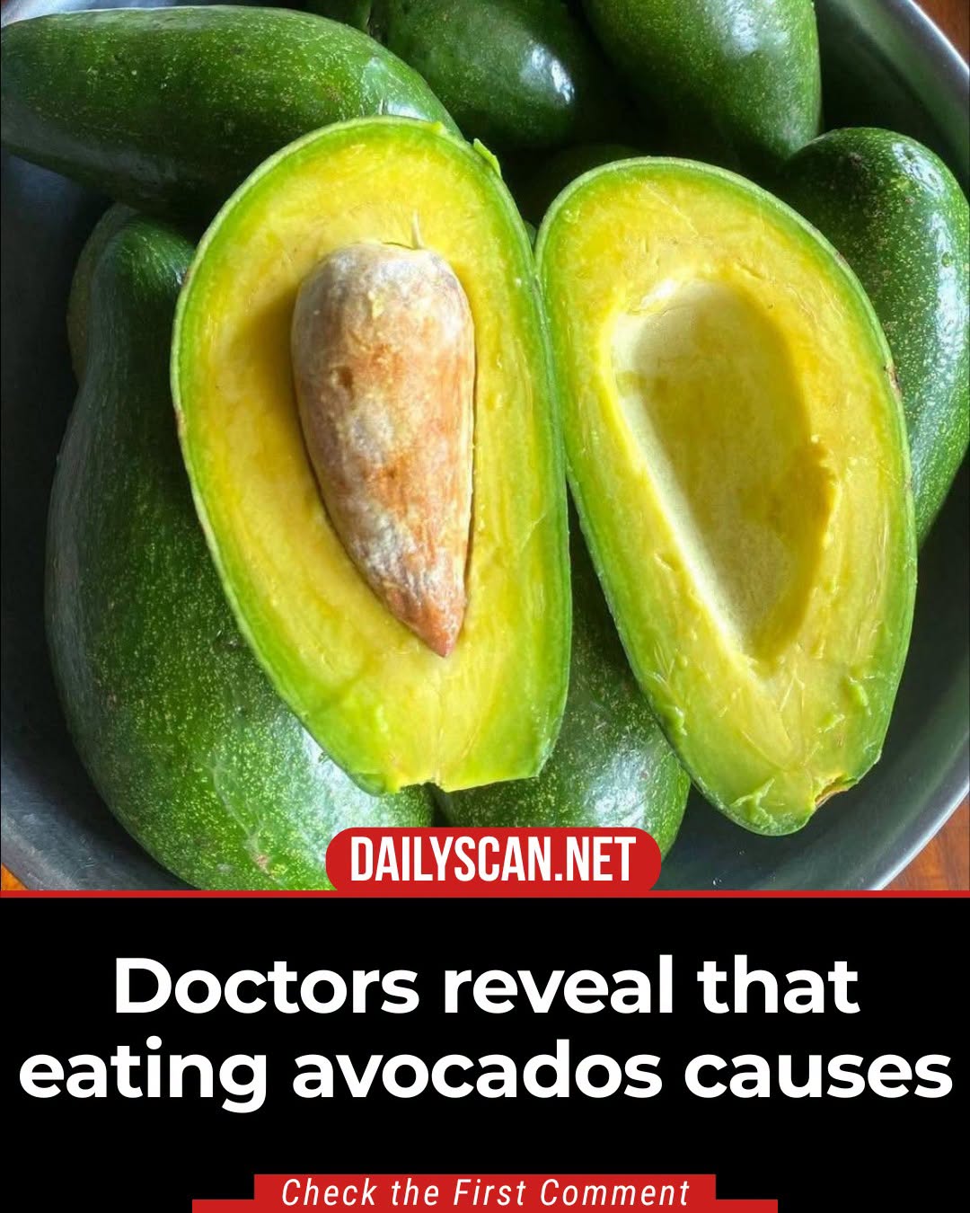 Doctors reveal that consuming avocado causes…