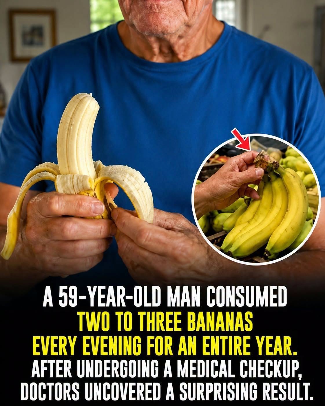 A 59-Year-Old Man Ate 2–3 Bananas Every Night for a Year — His Medical Checkup Revealed an Unexpected Finding