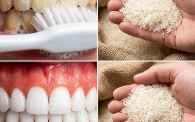A radiant smile in sixty seconds: the little-known rice-based method