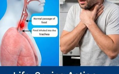 If You Start Choking and You’re Alone: What to Do in an Emergency