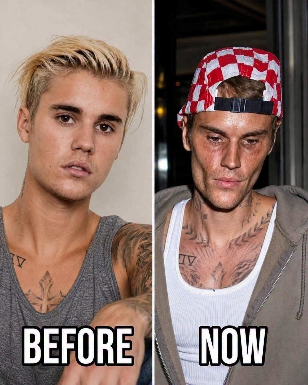 🥺Justin Bieber admits that he tested positive for…See more