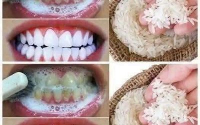 A way to whiten your teeth in just 1 minute that no dentist will tell you..