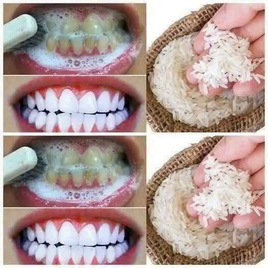 A way to whiten your teeth in just 1 minute that no dentist will tell you..