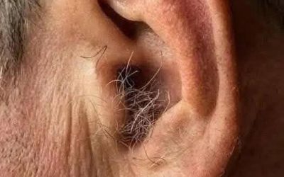 DID YOU KNOW? If hair grows on your ears, it’s because your body is…