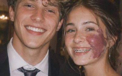 Only One Boy Asked Me To Prom Because Of My Birthmark—Until An Officer Walked In 1