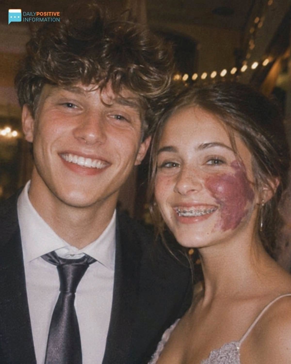 Only One Boy Asked Me To Prom Because Of My Birthmark—Until An Officer Walked In 1