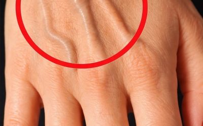 If your veins are visible, it means you are…