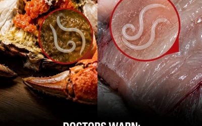 Before You Eat These 4 Foods, Know How Parasites Can Sometimes Hide in Them.