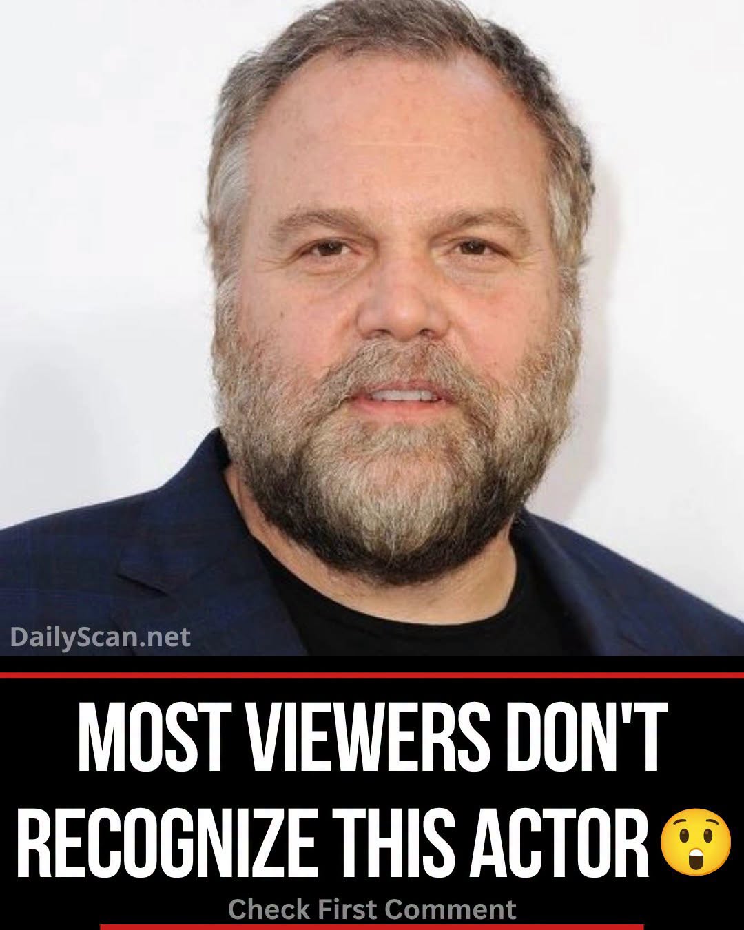 Women ran from Vincent D’Onofrio after break-through role