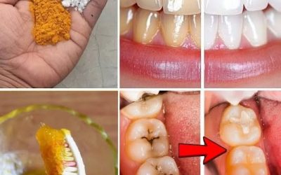 Please try this OUT !Turmeric for Teeth Whitening: Can This Natural Remedy Really Brighten Your Smile?..SEE MORE BELOW