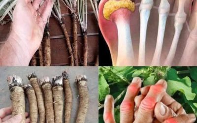 The Powerful Plant That May Support Cancer Treatment: A Closer Look at the Benefits of the Greater Burdock Root
