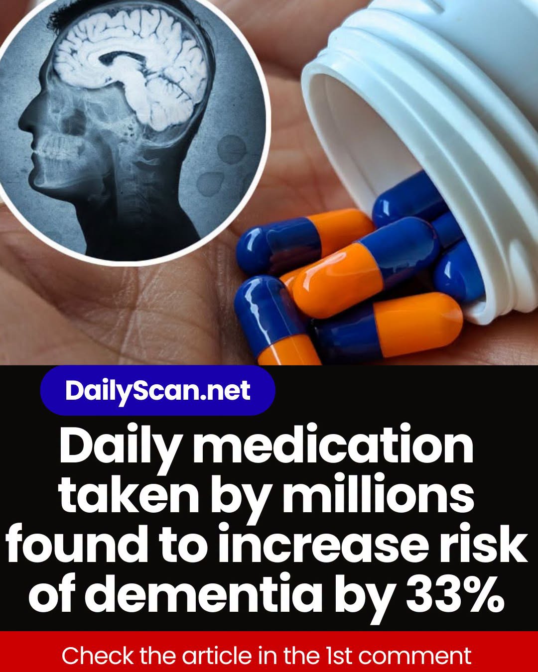 Daily medication taken by millions found to increase risk of dementia by 33%