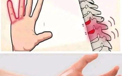 Hands Falling Asleep at Night? Paresthesia: Causes and Solutions