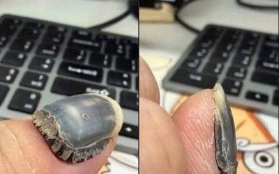 These are the consequences of using too much n… See more