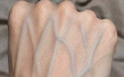 If your veins are visible in your hand, it is a signal