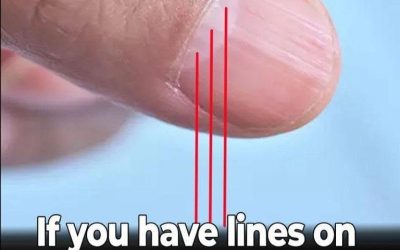 Doctor Uncovers A Telltale Sign In Your Fingernails That May Predict Your Life Expectancy
