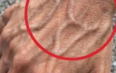 If Your Hand Veins Are Visible, Here’s What Your Body May Be Telling You