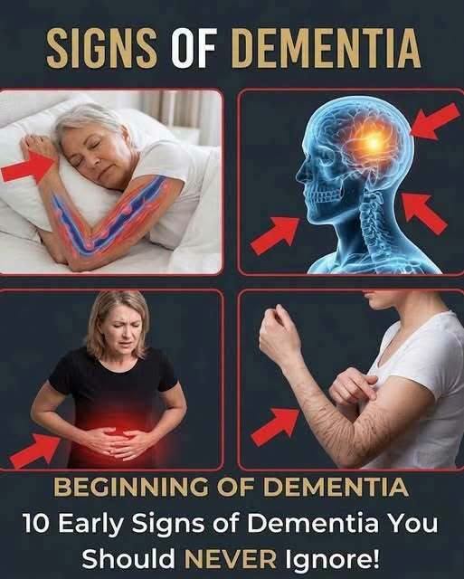 10 Signs of Dementia You Should Never Ignore