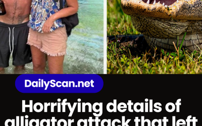 Horrifying details of alligator attack that left mom’s arm ‘hanging’ by a ‘thread’